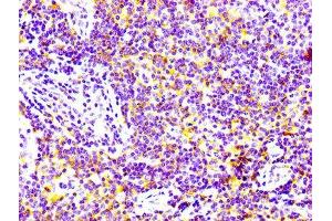 IHC image of ABIN7127287 diluted at 1:100 and staining in paraffin-embedded human lymph node tissue performed on a Leica BondTM system. (Recombinant CD97 antibody)