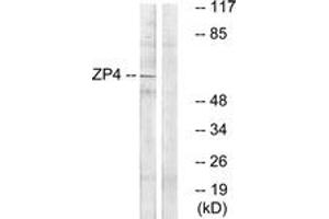 Western blot analysis of extracts from Jurkat cells, using ZP4 Antibody.