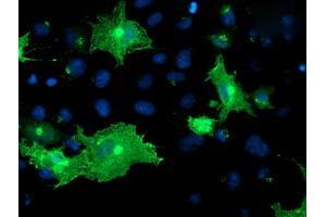 Anti-OSBP mouse monoclonal antibody (ABIN2454755) immunofluorescent staining of COS7 cells transiently transfected by pCMV6-ENTRY OSBP (RC204250). (OSBP antibody)