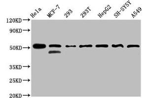 Western Blot Positive WB detected in: Hela whole cell lysate, MCF-7 whole cell lysate, 293 whole cell lysate, 293T whole cell lysate, HepG2 whole cell lysate, SH-SY5Y whole cell lysate, A549 whole cell lysate All lanes: PLAGL1 antibody at 3 μg/mL Secondary Goat polyclonal to rabbit IgG at 1/50000 dilution Predicted band size: 51, 45 kDa Observed band size: 51 kDa (PLAGL1 antibody  (AA 326-381))