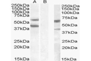 HEK293 overexpressing DGAT2 (lane A) and probed with ABIN190849 (mock transfection in laneB). (DGAT2 antibody  (Internal Region))