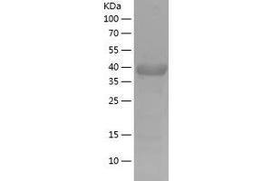 Western Blotting (WB) image for Salt-Inducible Kinase 2 (SIK2) (AA 827-926) protein (His-IF2DI Tag) (ABIN7281936) (SIK2 Protein (AA 827-926) (His-IF2DI Tag))