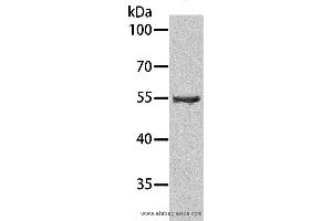 Western blot analysis of Human testis tissue, using SPATA6 Polyclonal Antibody at dilution of 1:1000 (SPATA6 antibody)