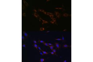 Immunofluorescence analysis of NIH/3T3 cells using  Rabbit pAb (ABIN7265726) at dilution of 1:100 (40x lens). (ABCA1 antibody  (AA 1870-2120))