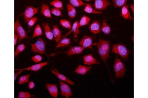 IF analysis of SMAD2 using anti-SMAD2 antibody (ABIN6719361). (SMAD2 antibody  (AA 83-264))