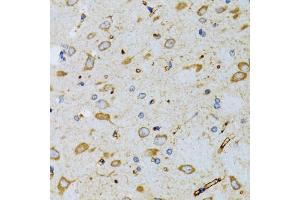 Immunohistochemistry of paraffin-embedded mouse brain using SRP19 antibody (ABIN2560139) at dilution of 1:100 (40x lens). (SRP19 antibody)
