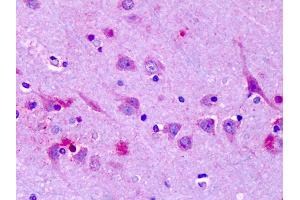Anti-OR6N1 antibody IHC of human brain, cortex, neurons. (OR6N1 antibody  (Extracellular Domain))