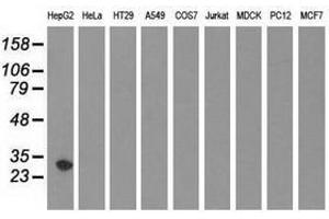Image no. 2 for anti-Sulfotransferase Family, Cytosolic, 2A, Dehydroepiandrosterone (DHEA)-Preferring, Member 1 (SULT2A1) antibody (ABIN1501235) (SULT2A1 antibody)