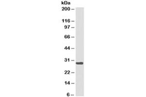 Western blot testing of Ramos cell lysate with HLA-DRB1 antibody cocktail (clones LN3 + HLA-DRB/1067). (HLA-DRB1 antibody)