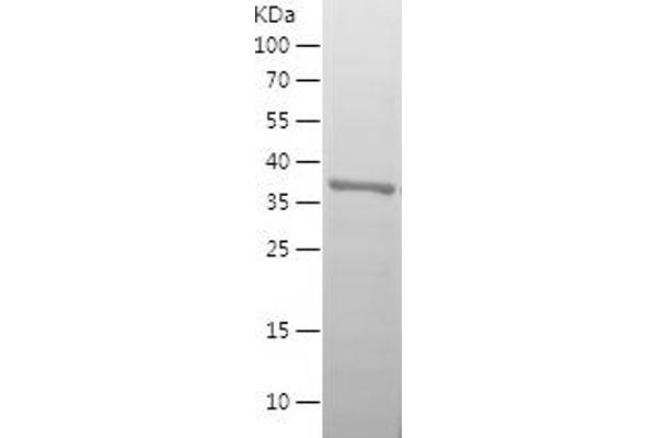 IGFBP3 Protein (AA 120-244) (His tag)