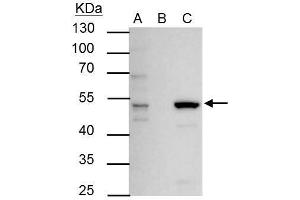 IP Image ERR alpha antibody immunoprecipitates ERR alpha protein in IP experiments. (ESRRA antibody)