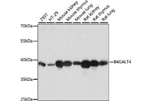 Western blot analysis of extracts of various cell lines, using B4G antibody (ABIN7271200) at 1:1000 dilution.