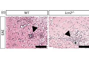 Immunohistochemistry (IHC) image for anti-Lipocalin 2 (LCN2) (AA 21-200) antibody (ABIN7433591)