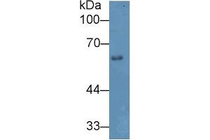 Western blot analysis of Mouse Skin lysate, using Mouse HPA Antibody (2 µg/ml) and HRP-conjugated Goat Anti-Rabbit antibody ( (HPSE antibody  (AA 353-464))