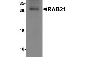Western blot analysis of RAB21 in mouse kidney tissue lysate with RAB21 antibody at 1 µg/mL. (RAB21 antibody  (C-Term))