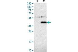 Western blot analysis of Lane 1: Negative control (vector only transfected HEK293T lysate), Lane 2: Over-expression Lysate (Co-expressed with a C-terminal myc-DDK tag (~3. (PPM1L antibody)