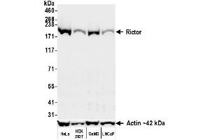 Western Blotting (WB) image for anti-RPTOR Independent Companion of mTOR, Complex 2 (RICTOR) (C-Term) antibody (ABIN7795813)