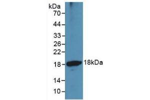 Western blot analysis of recombinant Human ADAMTS1.