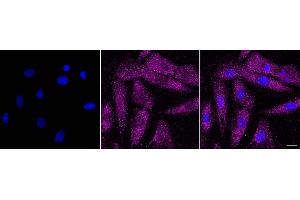 Immunocytochemical staining of H9C2 cells with PUM2 antibody(ABIN7800065), 1:1,000). (Recombinant PUM2 antibody)