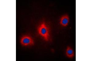 Immunofluorescent analysis of GRB10 (pY67) staining in PC12 cells. (GRB10 antibody  (N-Term, pTyr67))