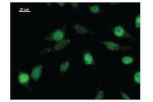 Immunostaining analysis in HeLa cells. (ZNF384 antibody)
