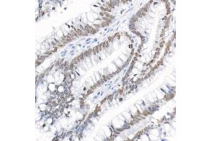 Immunohistochemistry (IHC) image for anti-Thymopoietin (TMPO) (AA 1-410) antibody (ABIN3016207)