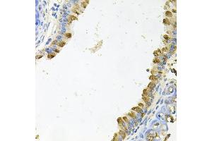 Immunohistochemistry of paraffin-embedded mouse lung using KLK11 antibody (ABIN6129404, ABIN6142947, ABIN6142949 and ABIN6222337) at dilution of 1:100 (40x lens). (Kallikrein 11 antibody  (AA 1-250))