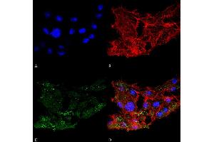 Immunocytochemistry/Immunofluorescence analysis using Rabbit Anti-ATG7 Polyclonal Antibody . (ATG7 antibody  (N-Term) (Biotin))