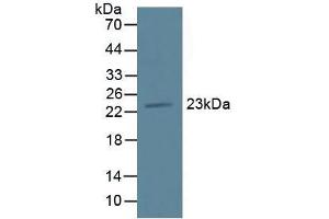 Figure. (TMEM27 antibody  (AA 12-222))