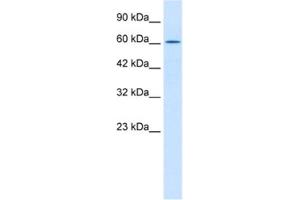 Western Blotting (WB) image for anti-TRIM17 / RNF16 (TRIM17) antibody (ABIN2460981) (TRIM17 / RNF16 antibody)