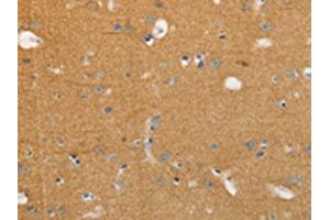 The image on the left is immunohistochemistry of paraffin-embedded Human brain tissue using ABIN7191634(NFASC Antibody) at dilution 1/30, on the right is treated with synthetic peptide. (NFASC antibody)