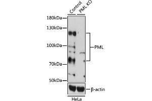 Western blot analysis of extracts from normal (control) and PML knockout (KO) HeLa cells, using PML antibody (ABIN3021658, ABIN3021659, ABIN3021660, ABIN1513388 and ABIN1514534) at 1:1000 dilution.