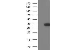 HEK293T cells were transfected with the pCMV6-ENTRY control (Left lane) or pCMV6-ENTRY TOMM34 (Right lane) cDNA for 48 hrs and lysed. (TOMM34 antibody)