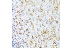 Immunohistochemistry of paraffin-embedded human esophagus using STK4 antibody. (STK4 antibody  (AA 303-487))