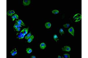 Immunofluorescent analysis of MCF-7 cells using ABIN7142312 at dilution of 1:100 and Alexa Fluor 488-congugated AffiniPure Goat Anti-Rabbit IgG(H+L) (HSD17B7 antibody  (AA 128-198))