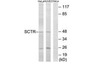 Western blot analysis of extracts from HeLa/HuvEc cells, using SCTR Antibody. (SCTR antibody  (AA 100-149))