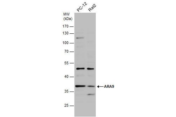 AIP antibody