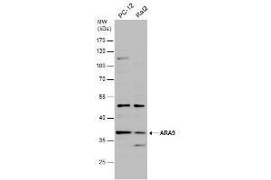 WB Image Various whole cell extracts (30 μg) were separated by 10% SDS-PAGE, and the membrane was blotted with ARA9 antibody [N1C3] , diluted at 1:500. (AIP antibody)