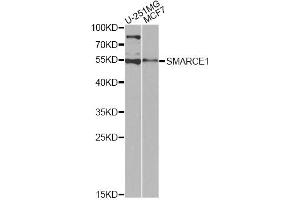 Western blot analysis of extracts of various cell lines, using SMARCE1 antibody (ABIN6290090) at 1:1000 dilution. (SMARCE1 antibody)