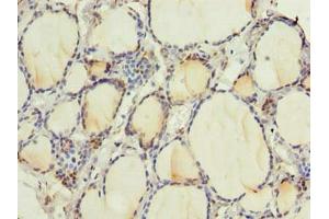 Immunohistochemistry of paraffin-embedded human thyroid tissue using ABIN7168256 at dilution of 1:100 (RNF24 antibody  (AA 45-148))