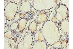 Immunohistochemistry of paraffin-embedded human thyroid tissue using ABIN7168256 at dilution of 1:100