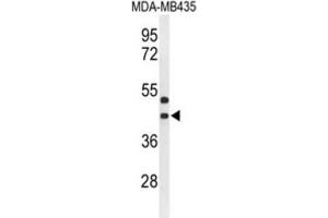 Western Blotting (WB) image for anti-G Protein-Coupled Receptor 17 (GPR17) antibody (ABIN3004347)