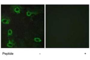 Immunofluorescence analysis of COS-7 cells, using ADORA2A polyclonal antibody . (Adenosine A2a Receptor antibody)