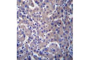 Immunohistochemistry analysis in human liver tissue (formalin-fixed, paraffin-embedded) using GPR34  Antibody , followed by peroxidase conjugation of the secondary antibody and DAB staining. (GPR34 antibody  (Middle Region))