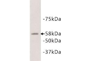 Western Blotting (WB) image for anti-Alkaline Phosphatase (ALP) antibody (ABIN1854820)