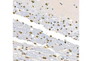 Immunohistochemistry (Paraffin-embedded Sections) (IHC (p)) image for anti-Transketolase (TKT) antibody (ABIN7075978)