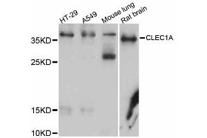 Western blot analysis of extracts of various cell lines, using CLEC1A antibody (ABIN5997458) at 1/1000 dilution.