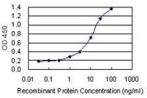 Detection limit for recombinant GST tagged ANP32B is 0. (ANP32B antibody  (AA 1-251))