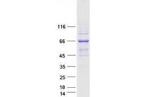 Validation with Western Blot (ZAP70 Protein (Transcript Variant 1) (Myc-DYKDDDDK Tag))