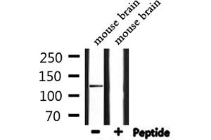 Western blot analysis of extracts from mouse brain, using iNOS Antibody.